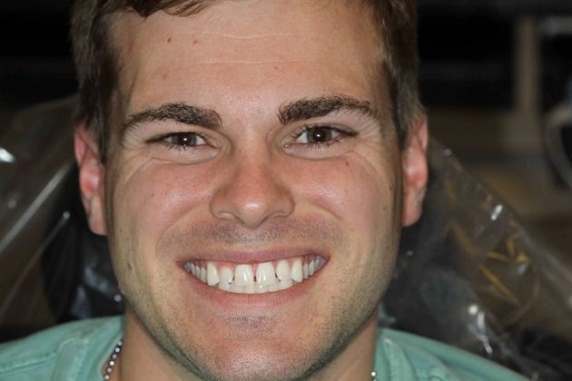 Patient before a smile makeover